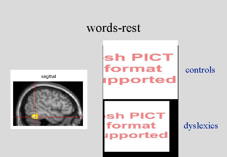 words-rest controls dyslexics 