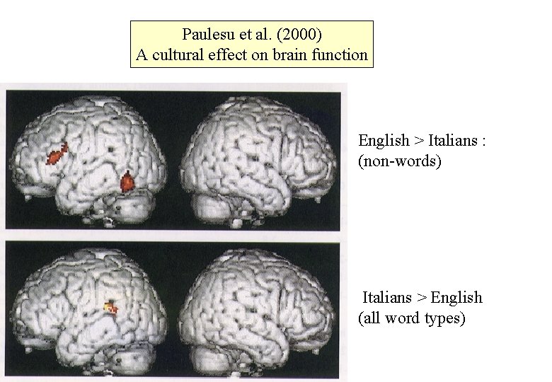 Paulesu et al. (2000) A cultural effect on brain function English > Italians :