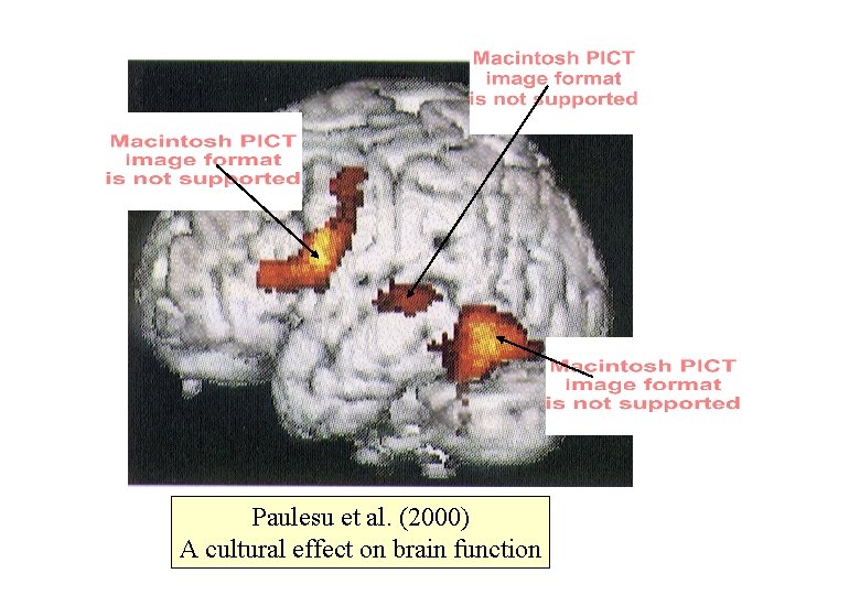 Paulesu et al. (2000) A cultural effect on brain function 