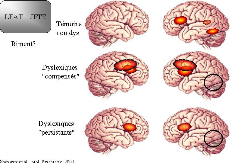 LEAT JETE Témoins non dys Riment? Dyslexiques "compensés" Dyslexiques "persistants" 