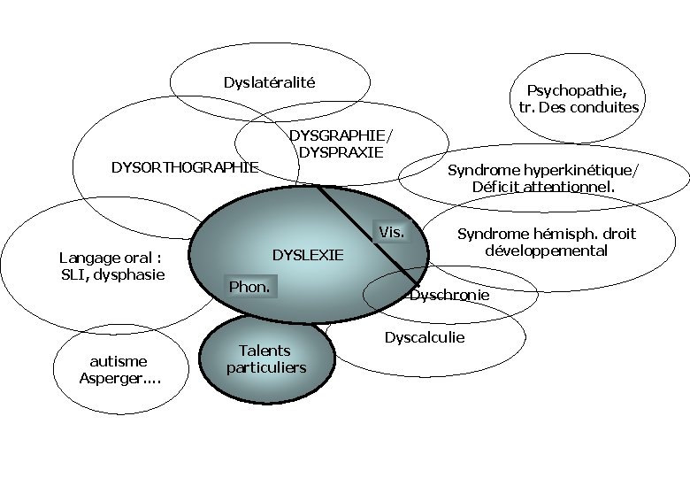 Dyslatéralité DYSORTHOGRAPHIE Psychopathie, tr. Des conduites DYSGRAPHIE/ DYSPRAXIE Syndrome hyperkinétique/ Déficit attentionnel. Vis. Langage