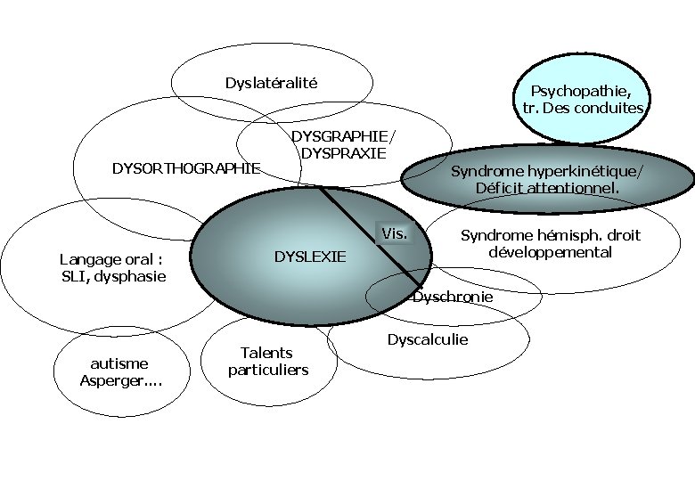 Dyslatéralité DYSORTHOGRAPHIE Psychopathie, tr. Des conduites DYSGRAPHIE/ DYSPRAXIE Syndrome hyperkinétique/ Déficit attentionnel. Vis. Langage