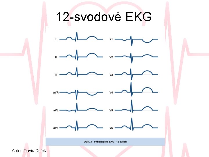 12 -svodové EKG Autor: David Dufek 