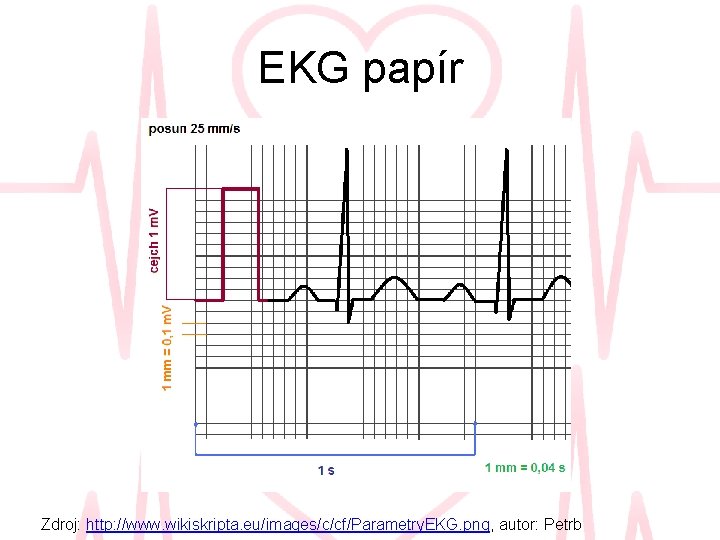 EKG papír Zdroj: http: //www. wikiskripta. eu/images/c/cf/Parametry. EKG. png, autor: Petrb 