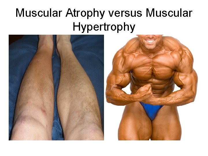 Muscular Atrophy versus Muscular Hypertrophy 