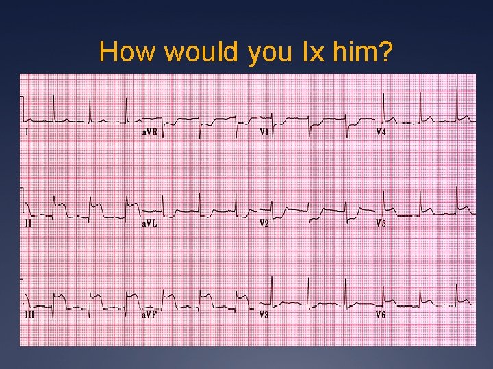 How would you Ix him? 