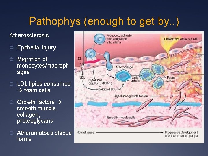 Pathophys (enough to get by. . ) Atherosclerosis Ü Epithelial injury Ü Migration of