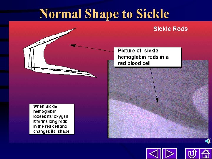 Normal Shape to Sickle 