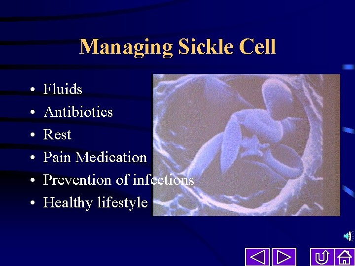 Managing Sickle Cell • • • Fluids Antibiotics Rest Pain Medication Prevention of infections