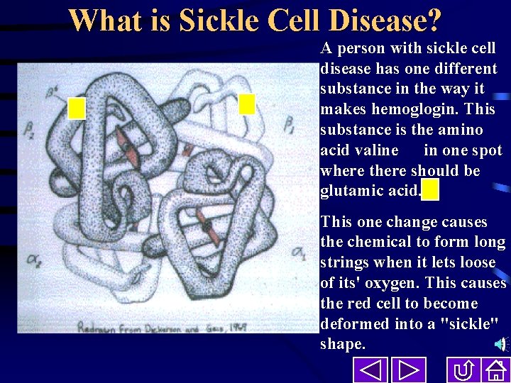 What is Sickle Cell Disease? A person with sickle cell disease has one different