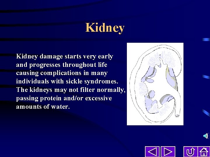 Kidney damage starts very early and progresses throughout life causing complications in many individuals