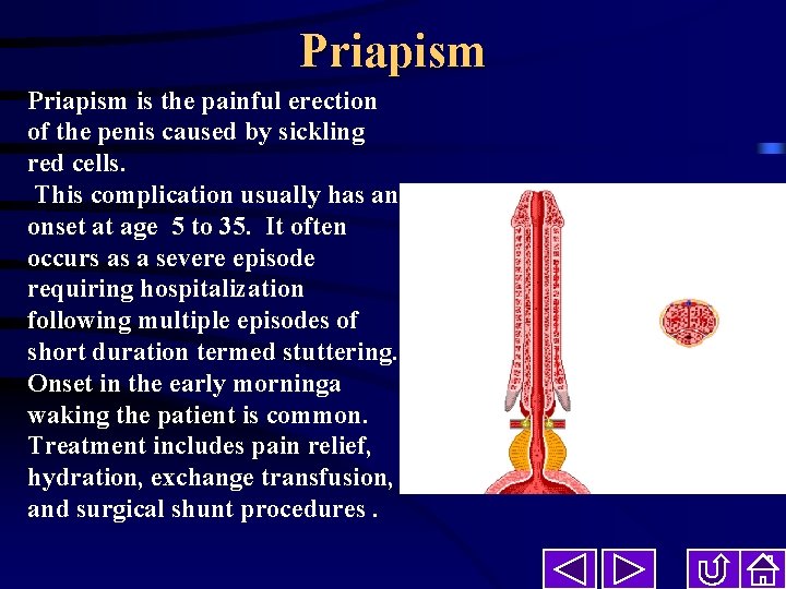 Priapism is the painful erection of the penis caused by sickling red cells. This