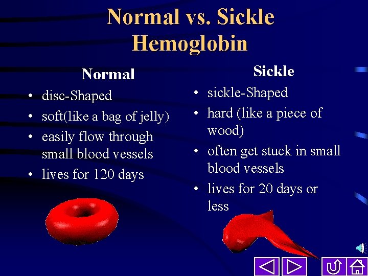 Normal vs. Sickle Hemoglobin Normal • disc-Shaped • soft(like a bag of jelly) •