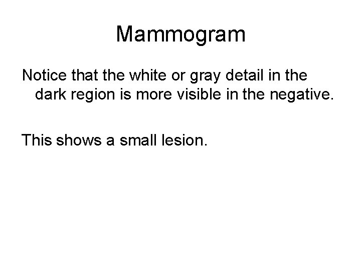 Mammogram Notice that the white or gray detail in the dark region is more