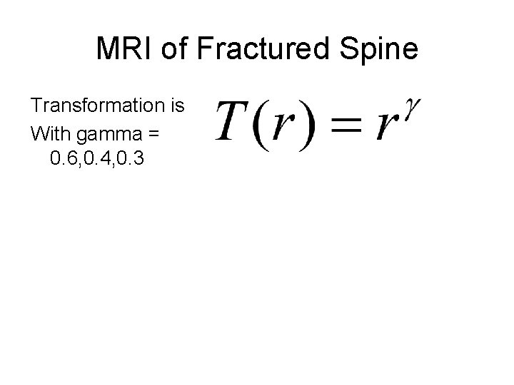 MRI of Fractured Spine Transformation is With gamma = 0. 6, 0. 4, 0.