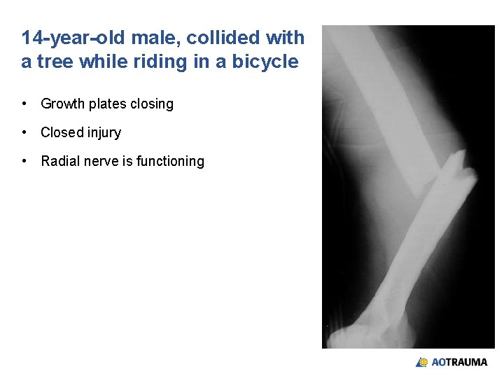 14 -year-old male, collided with a tree while riding in a bicycle • Growth