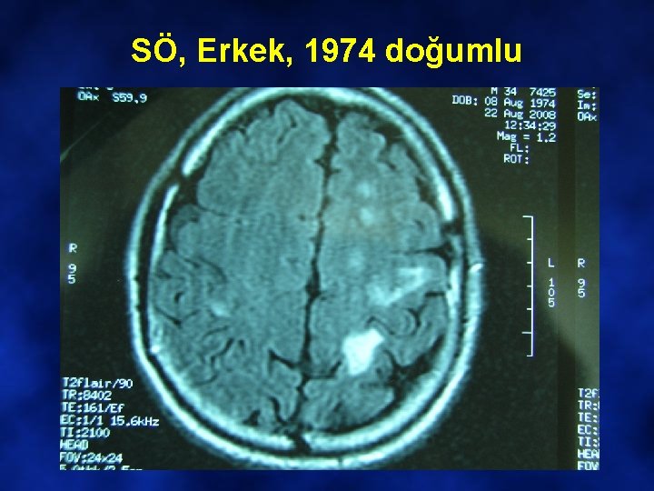 SÖ, Erkek, 1974 doğumlu 