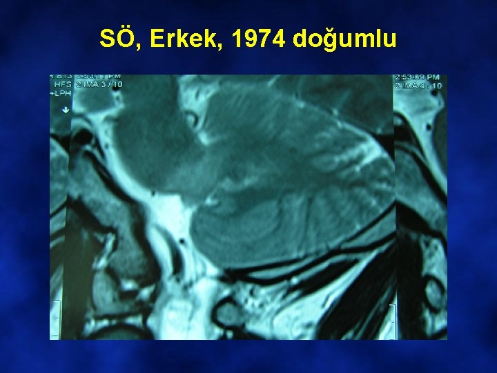 SÖ, Erkek, 1974 doğumlu 