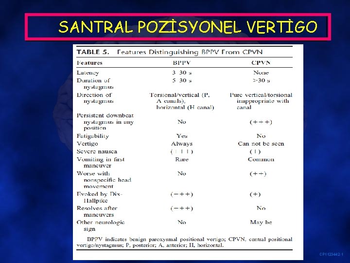 SANTRAL POZİSYONEL VERTİGO CP 1123442 -1 