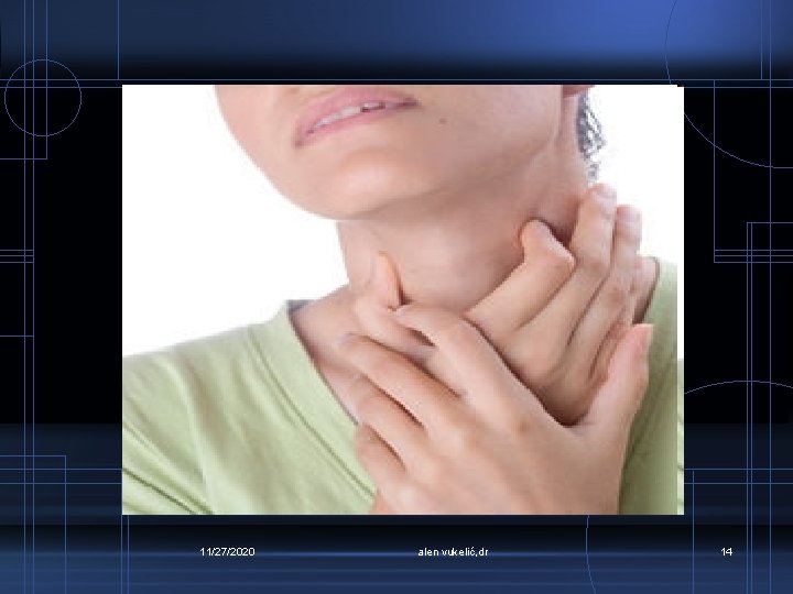 11/27/2020 alen vukelić, dr 14 