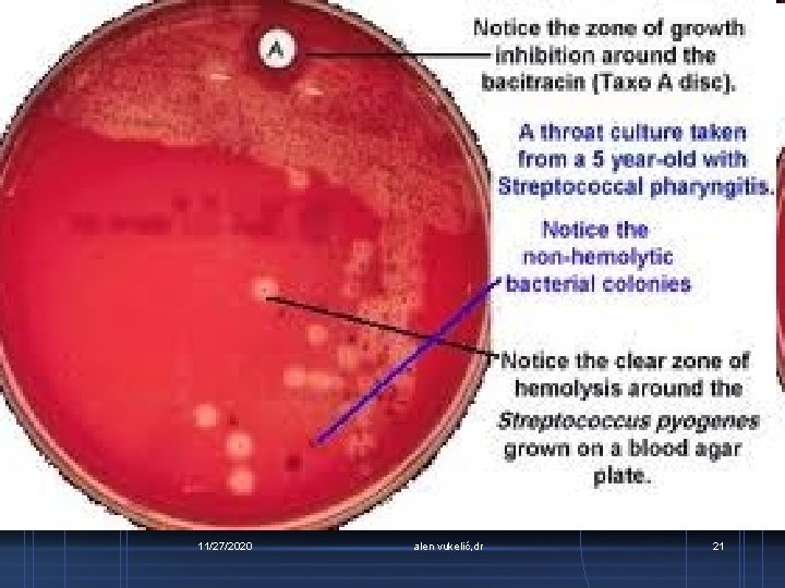 11/27/2020 alen vukelić, dr 21 