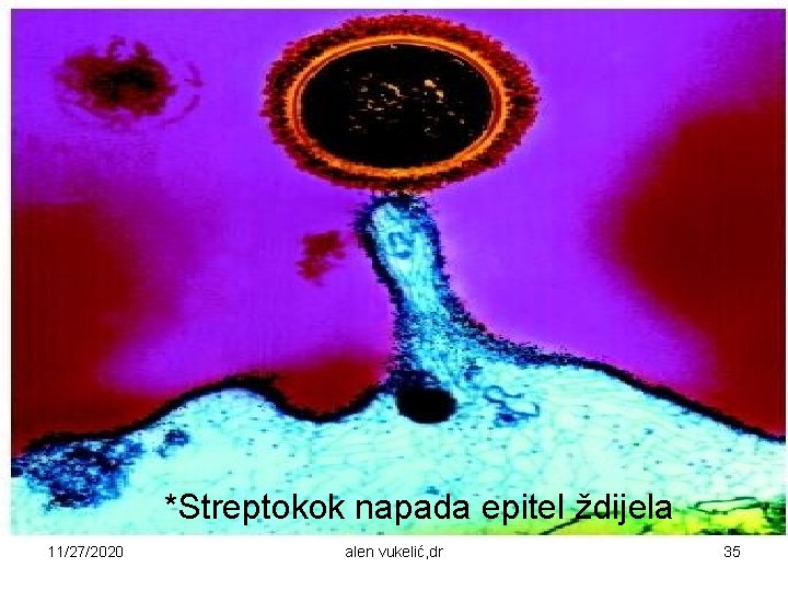 *Streptokok napada epitel ždijela 11/27/2020 alen vukelić, dr 35 