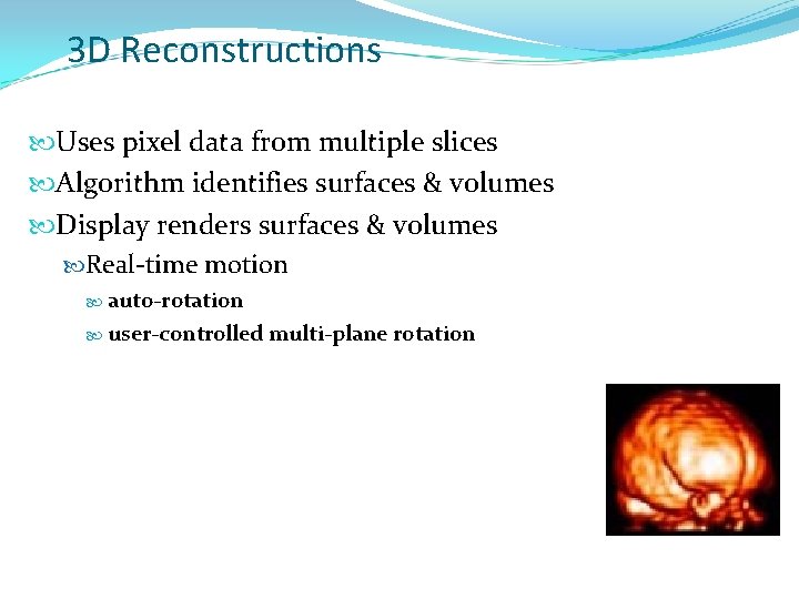 3 D Reconstructions Uses pixel data from multiple slices Algorithm identifies surfaces & volumes