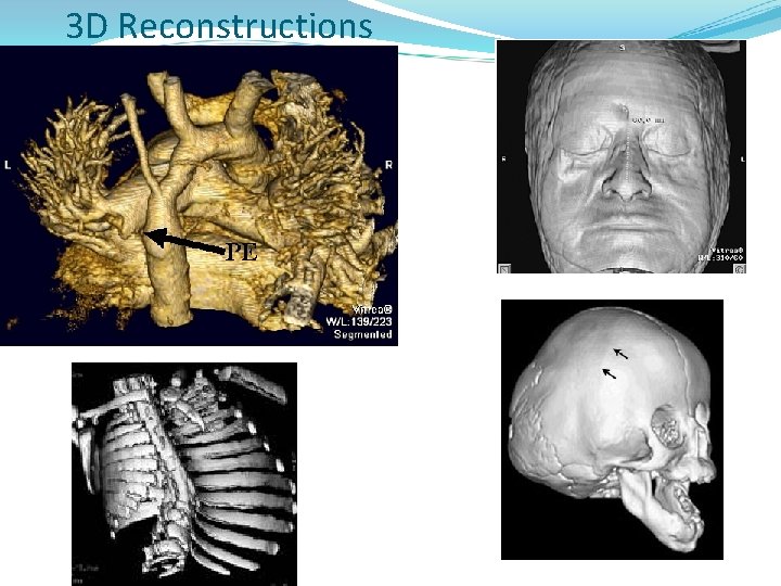 3 D Reconstructions 