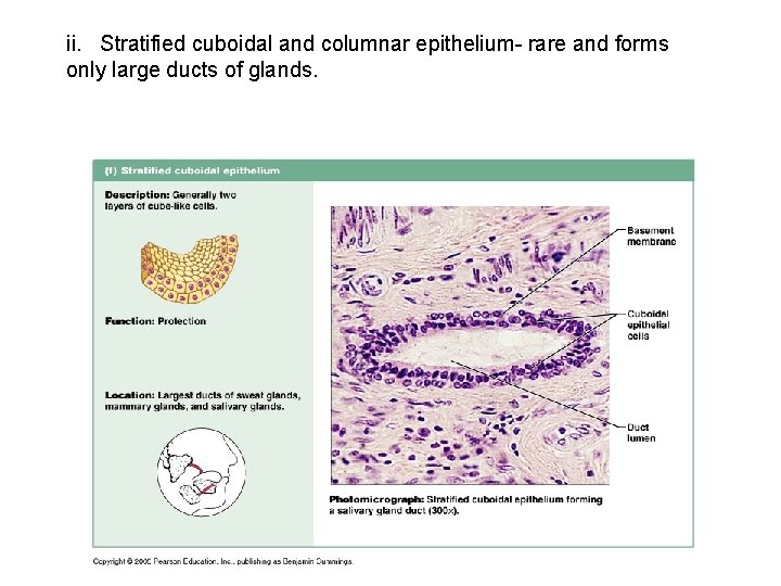 ii. Stratified cuboidal and columnar epithelium- rare and forms only large ducts of glands.