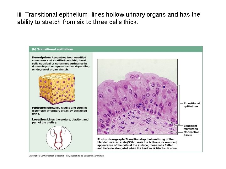 iii Transitional epithelium- lines hollow urinary organs and has the ability to stretch from