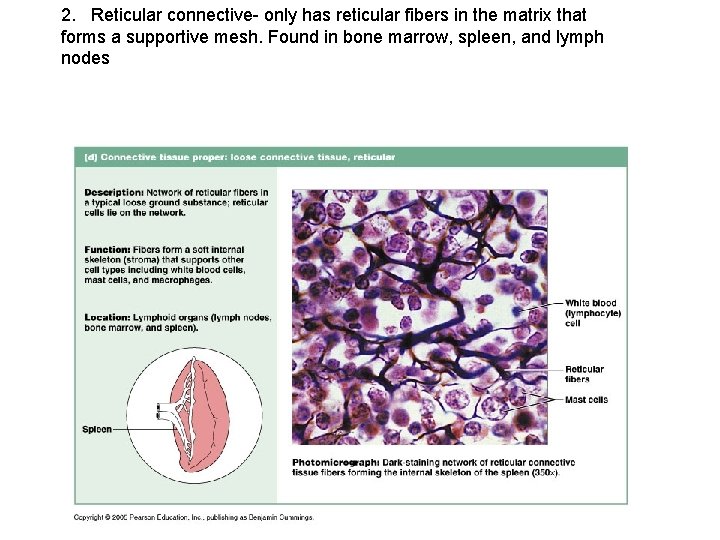 2. Reticular connective- only has reticular fibers in the matrix that forms a supportive