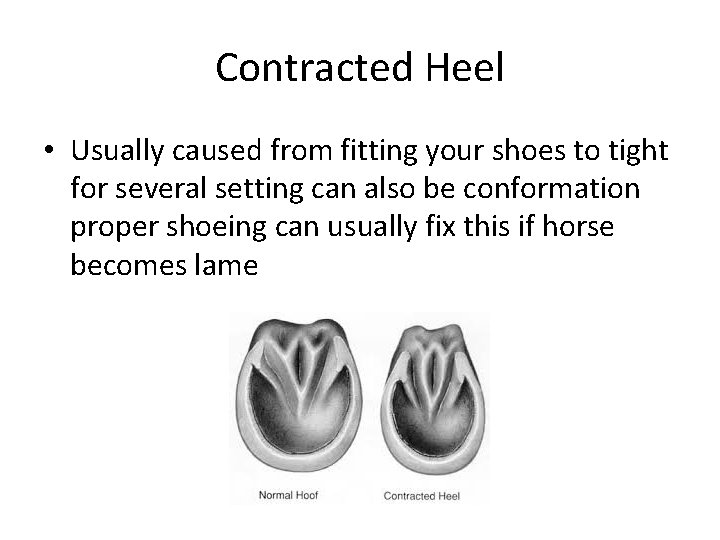 Contracted Heel • Usually caused from fitting your shoes to tight for several setting Contracted Heel • Usually caused from fitting your shoes to tight for several setting