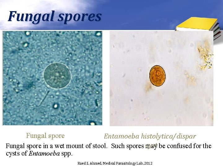 Fungal spores Entamoeba histolytica/dispar cyst Fungal spore in a wet mount of stool. Such
