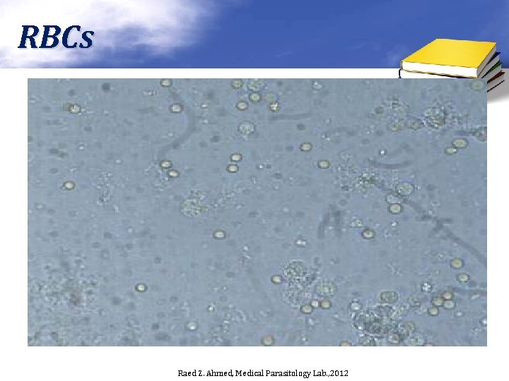 RBCs Raed Z. Ahmed, Medical Parasitology Lab. , 2012 