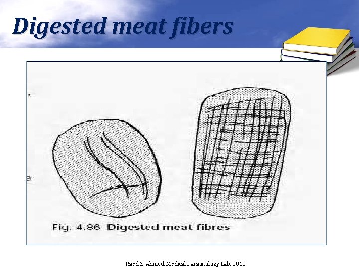 Digested meat fibers Raed Z. Ahmed, Medical Parasitology Lab. , 2012 