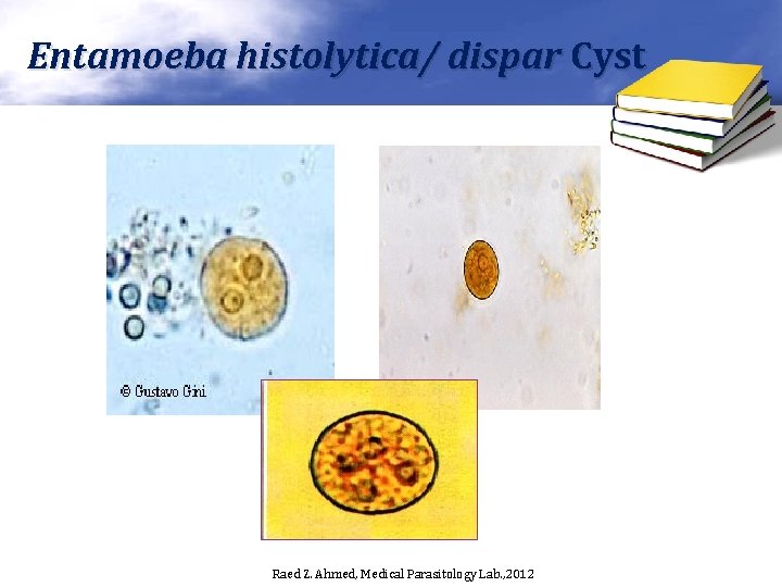 Entamoeba histolytica/ dispar Cyst Raed Z. Ahmed, Medical Parasitology Lab. , 2012 
