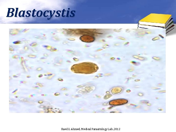 Blastocystis Raed Z. Ahmed, Medical Parasitology Lab. , 2012 