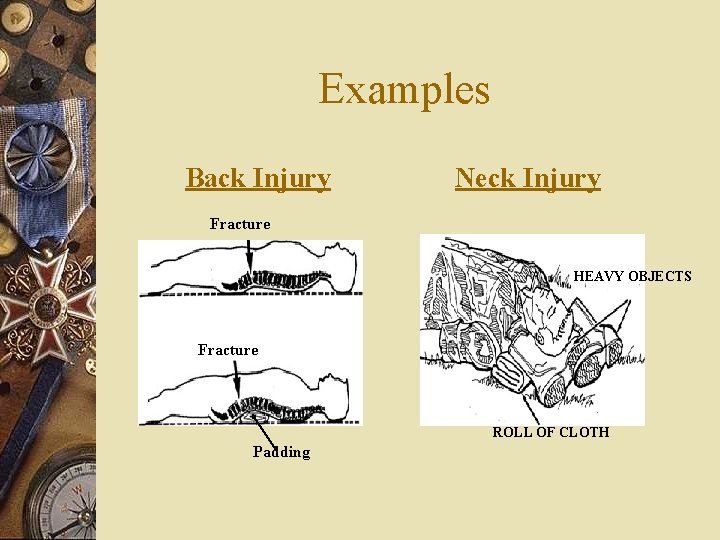Examples Back Injury Neck Injury Fracture HEAVY OBJECTS Fracture ROLL OF CLOTH Padding 