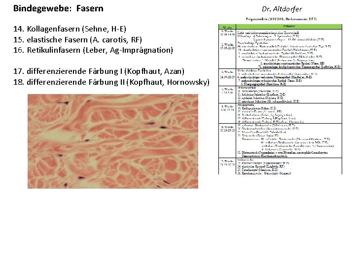 Bindegewebe: Fasern 14. Kollagenfasern (Sehne, H-E) 15. elastische Fasern (A. carotis, RF) 16. Retikulinfasern