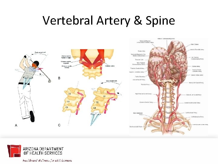 Vertebral Artery & Spine 