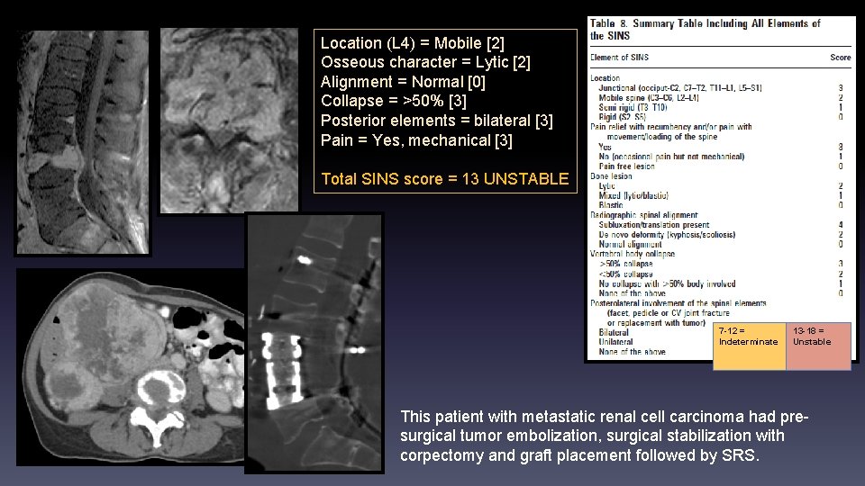 Location (L 4) = Mobile [2] Osseous character = Lytic [2] Alignment = Normal