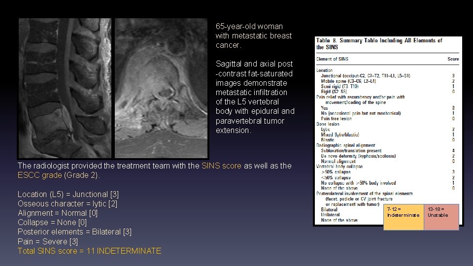 65 -year-old woman with metastatic breast cancer. Sagittal and axial post -contrast fat-saturated images