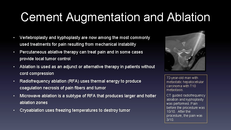 Cement Augmentation and Ablation • Vertebroplasty and kyphoplasty are now among the most commonly