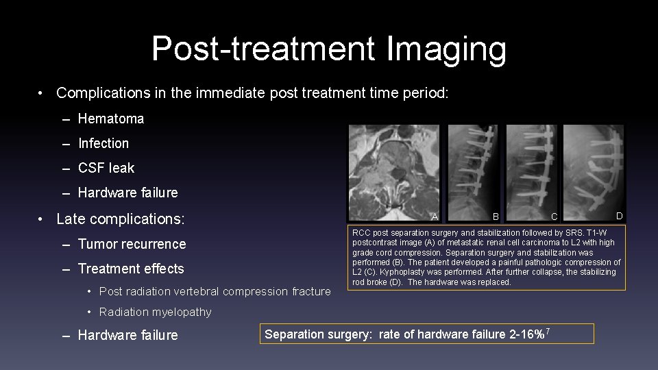 Post-treatment Imaging • Complications in the immediate post treatment time period: – Hematoma –