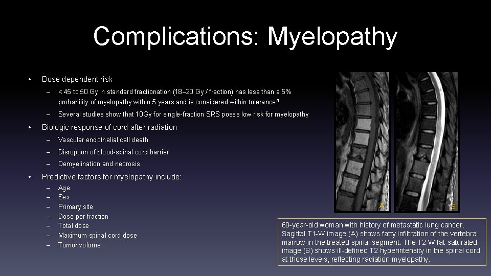Complications: Myelopathy • Dose dependent risk – < 45 to 50 Gy in standard