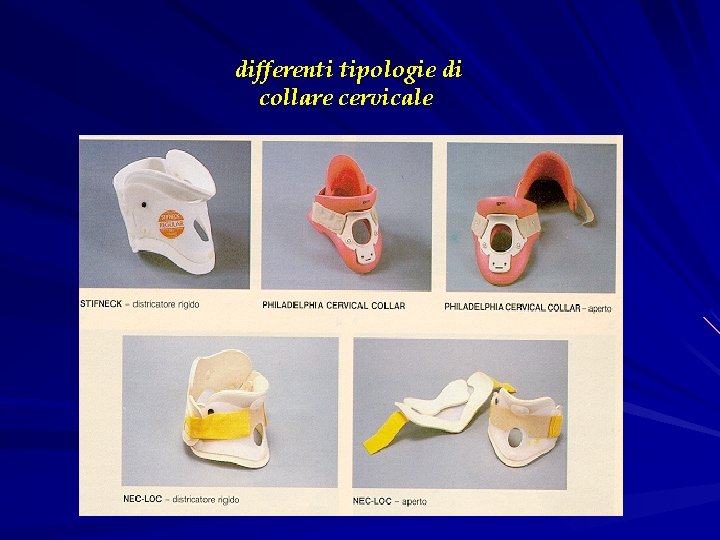 differenti tipologie di collare cervicale 