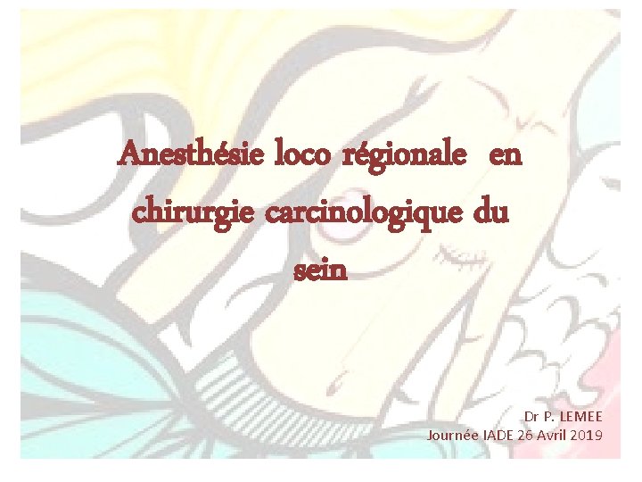Anesthésie loco régionale en Analgésie chirurgie du sein chirurgie carcinologique du sein Dr P.