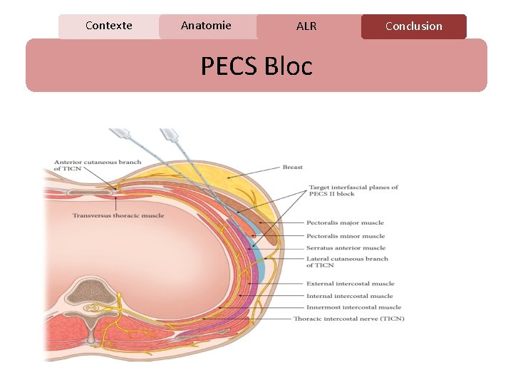 Contexte Anatomie C ALR PECS Bloc Conclusion 