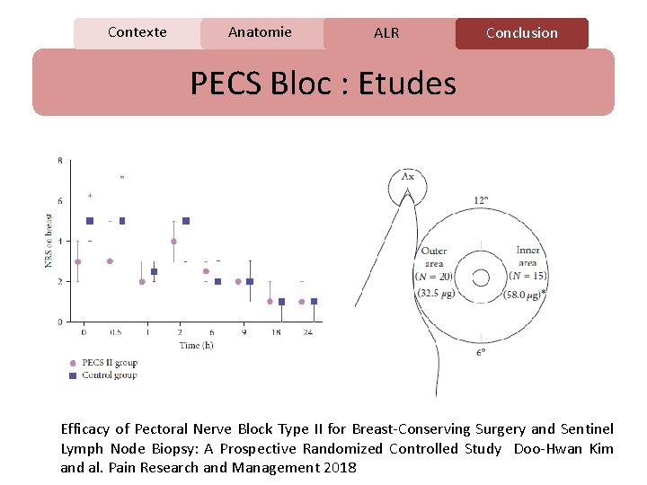 Contexte Anatomie C ALR Conclusion PECS Bloc : Etudes Efficacy of Pectoral Nerve Block