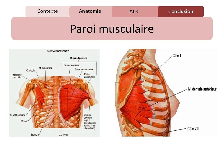 Contexte Anatomie C ALR Paroi musculaire Conclusion 